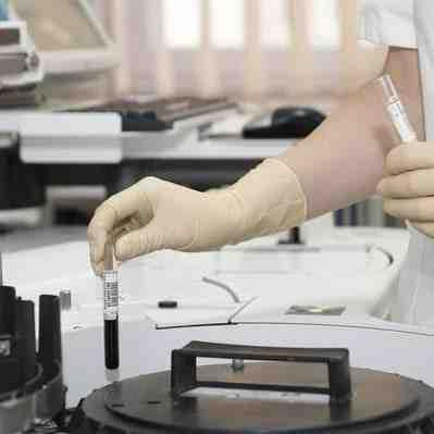 Motor oil lab - analysis - Do the check now & check the condition of your oil! Oil check oil test check-up